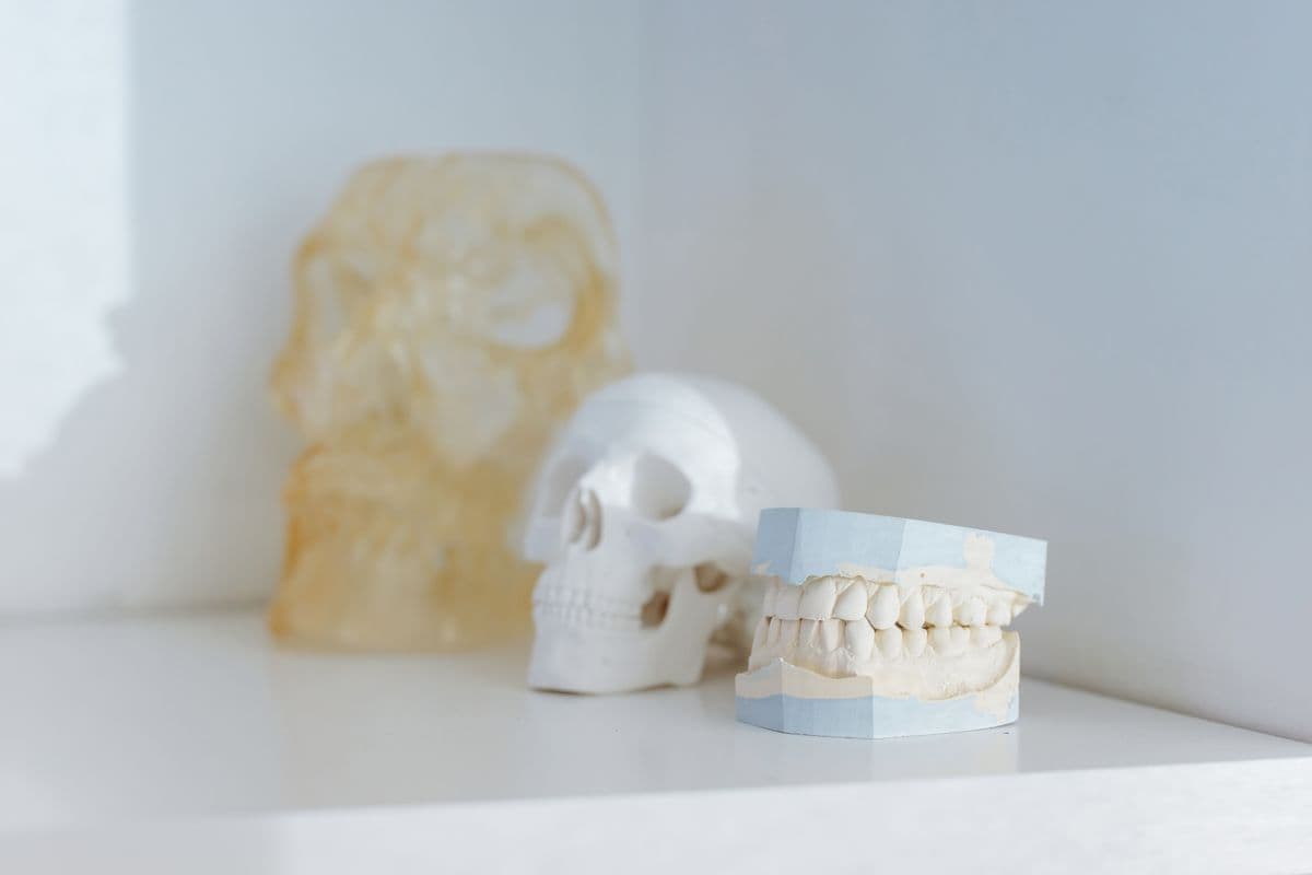Dental stone cast models and anatomical references used in complete denture design