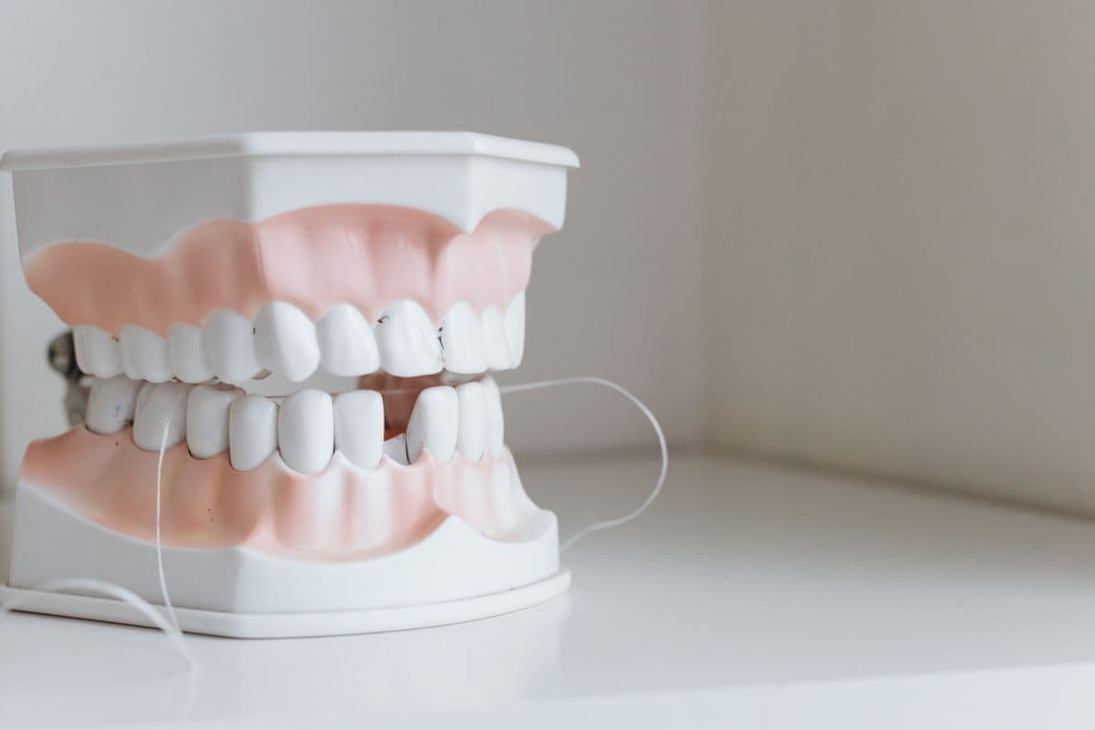 Dental arch model with a missing tooth gap illustrating partial denture planning
